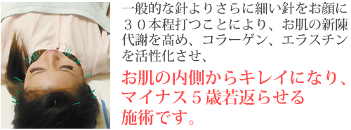 一般的な針よりさらに細い針をお顔の３０本程打つことにより、お肌の新陳代謝を高め、コラーゲン、エラスチンを活性化させ、お肌の内側からキレイになり、マイナス５歳若返らせる施術です。