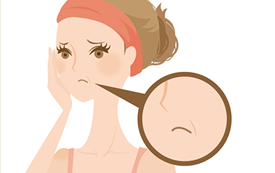 しわ・ほうれいせんでお悩みの方