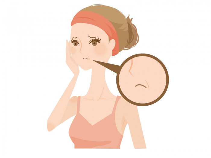 しわ、ほうれい線