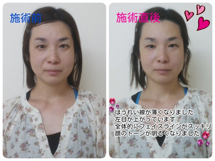 胡内さん Kさん